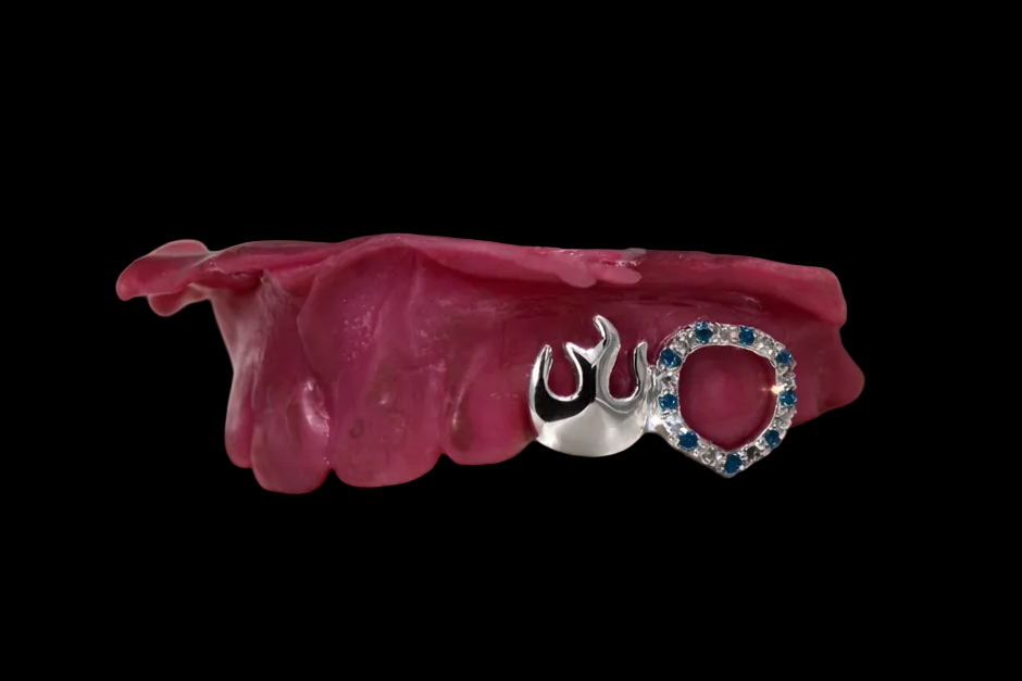 Frosted Flame ❄️🔥 Grillz