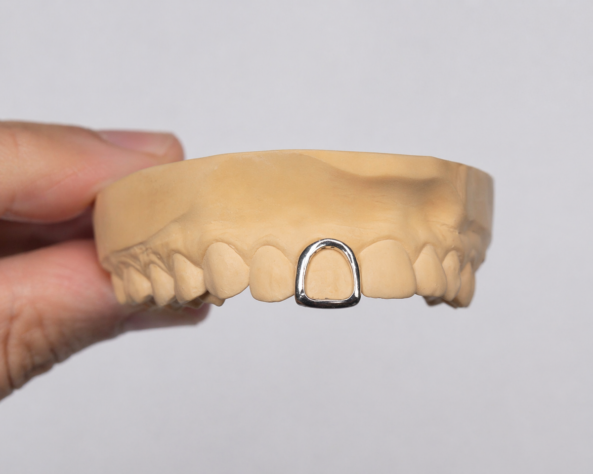 Plain Jane Rim Grillz - Single Cap