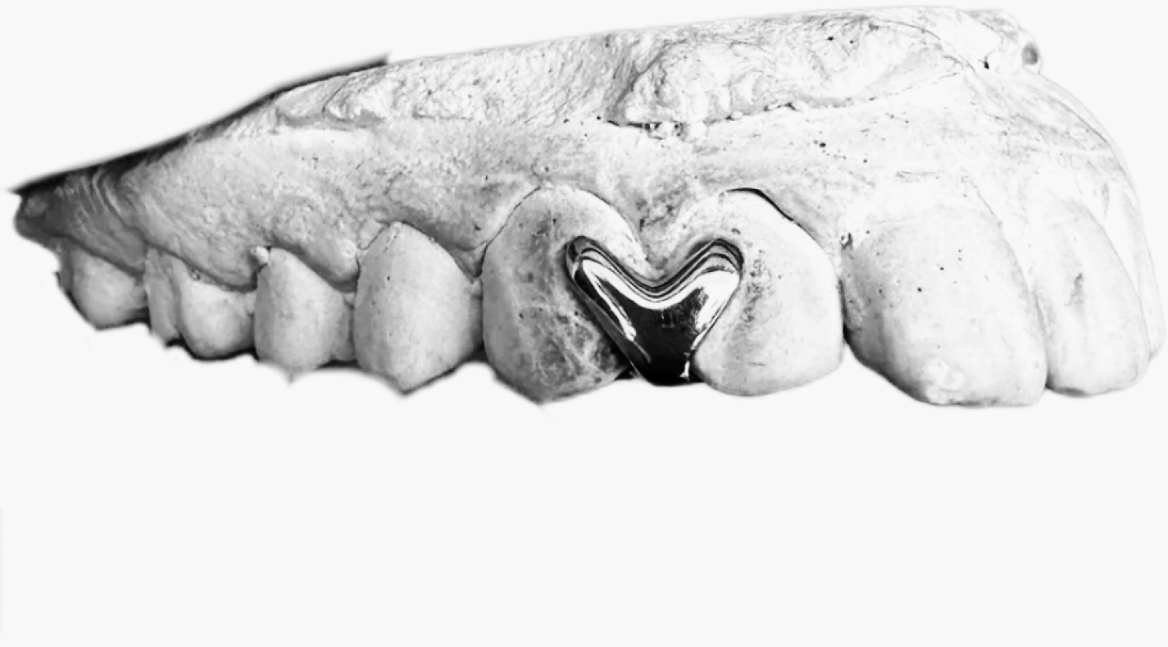 The Love Mold Grillz