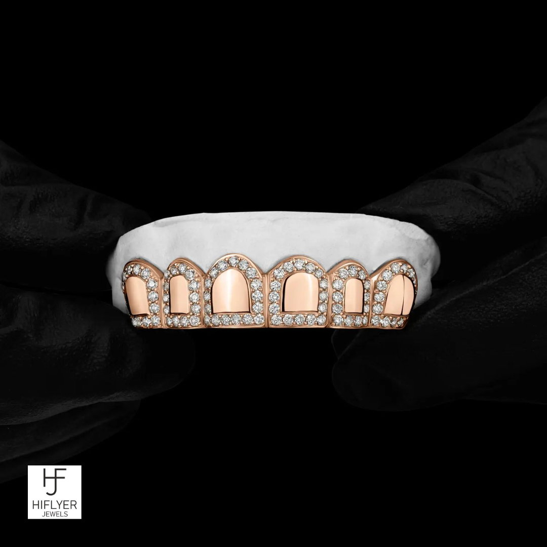 Roman pillar Grillz