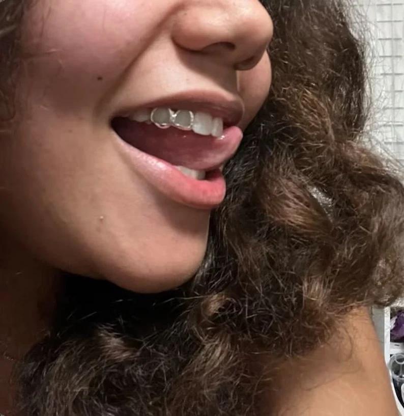 Duo classic Openwork Grillz