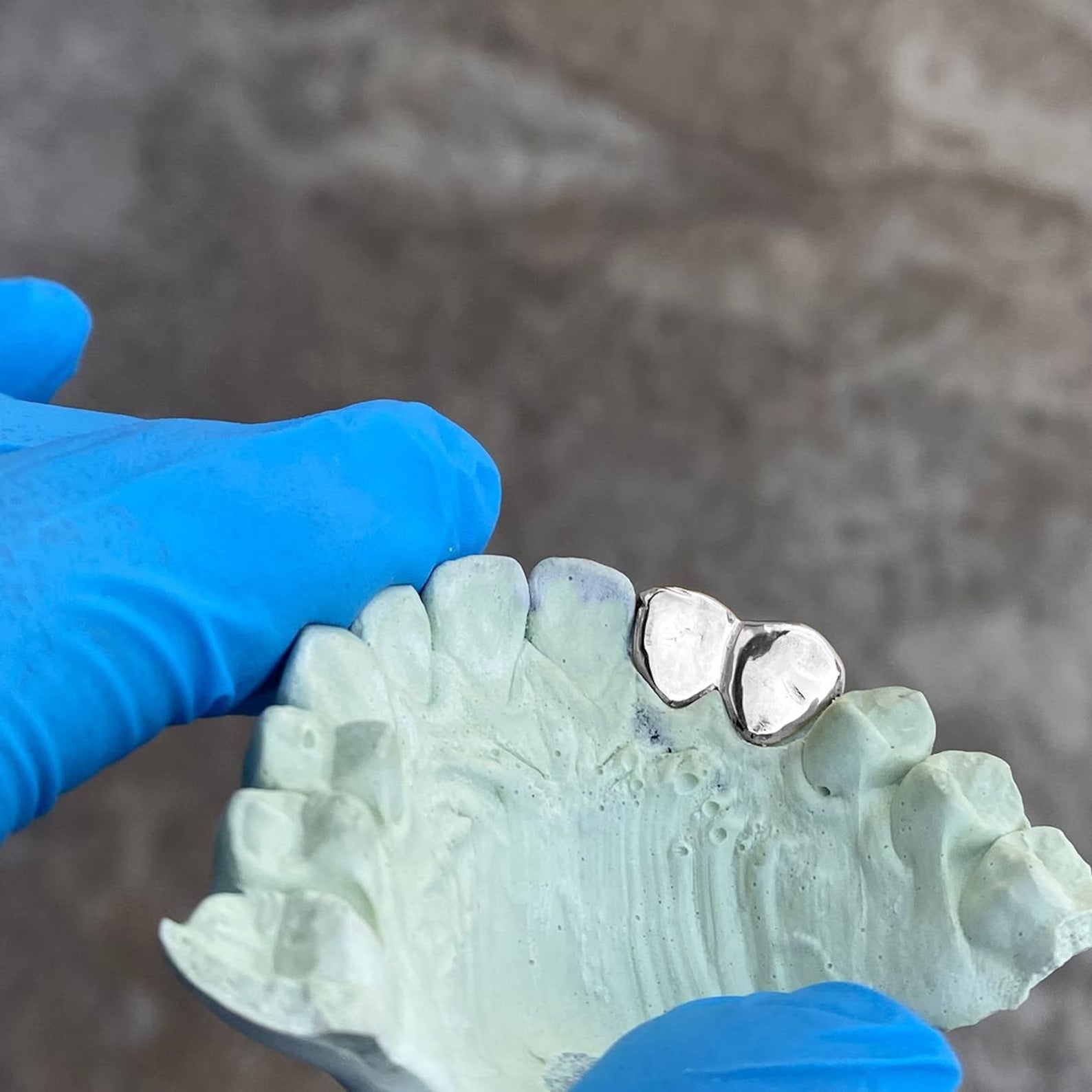 Twin Metallic Grillz