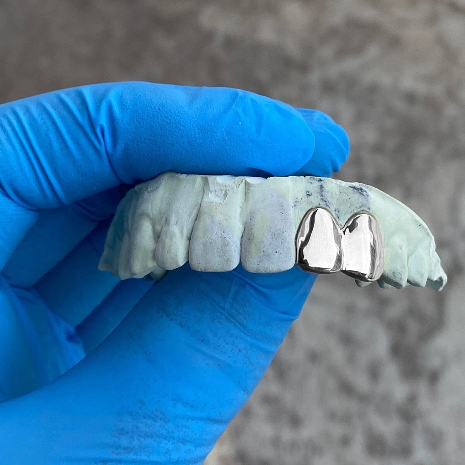 Twin Metallic Grillz