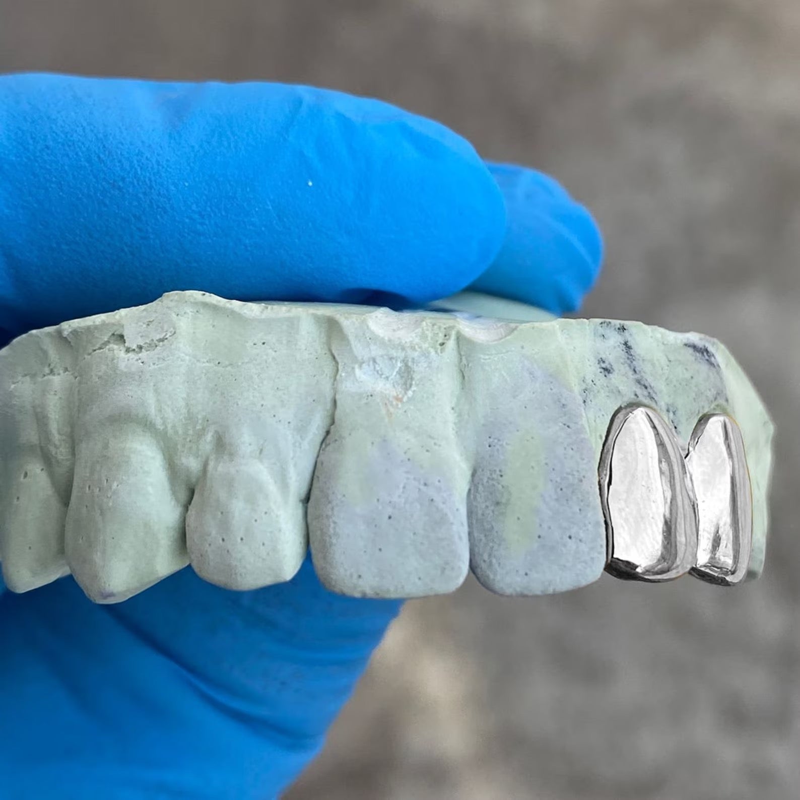 Twin Metallic Grillz
