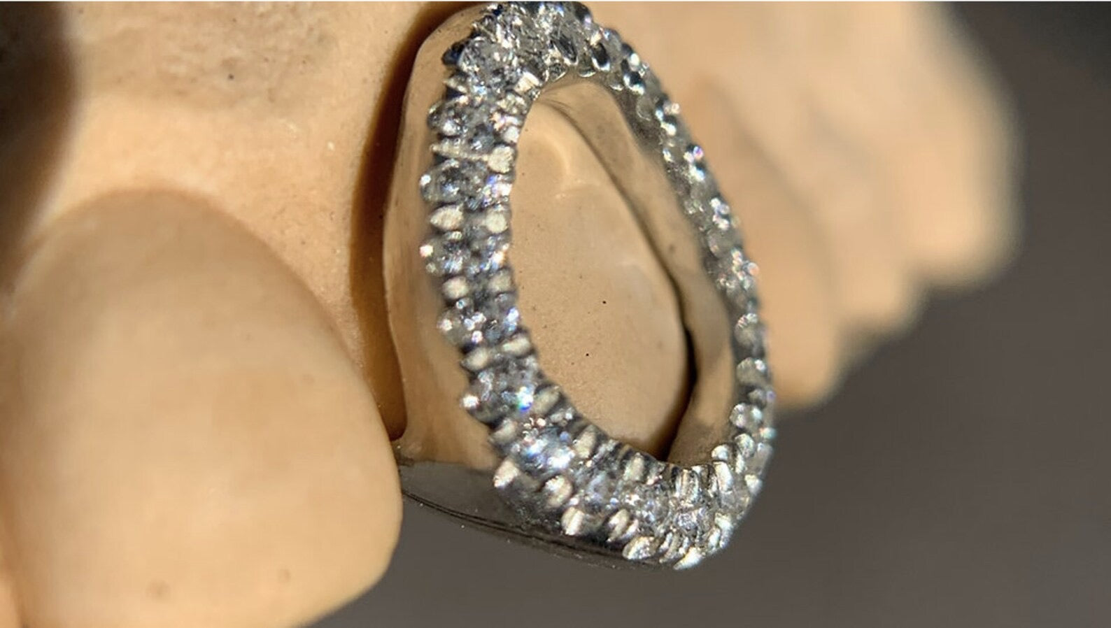 Iced out Openwork Grillz (1 cap)