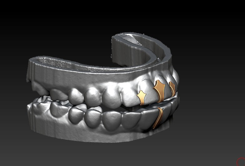 Trident grillz