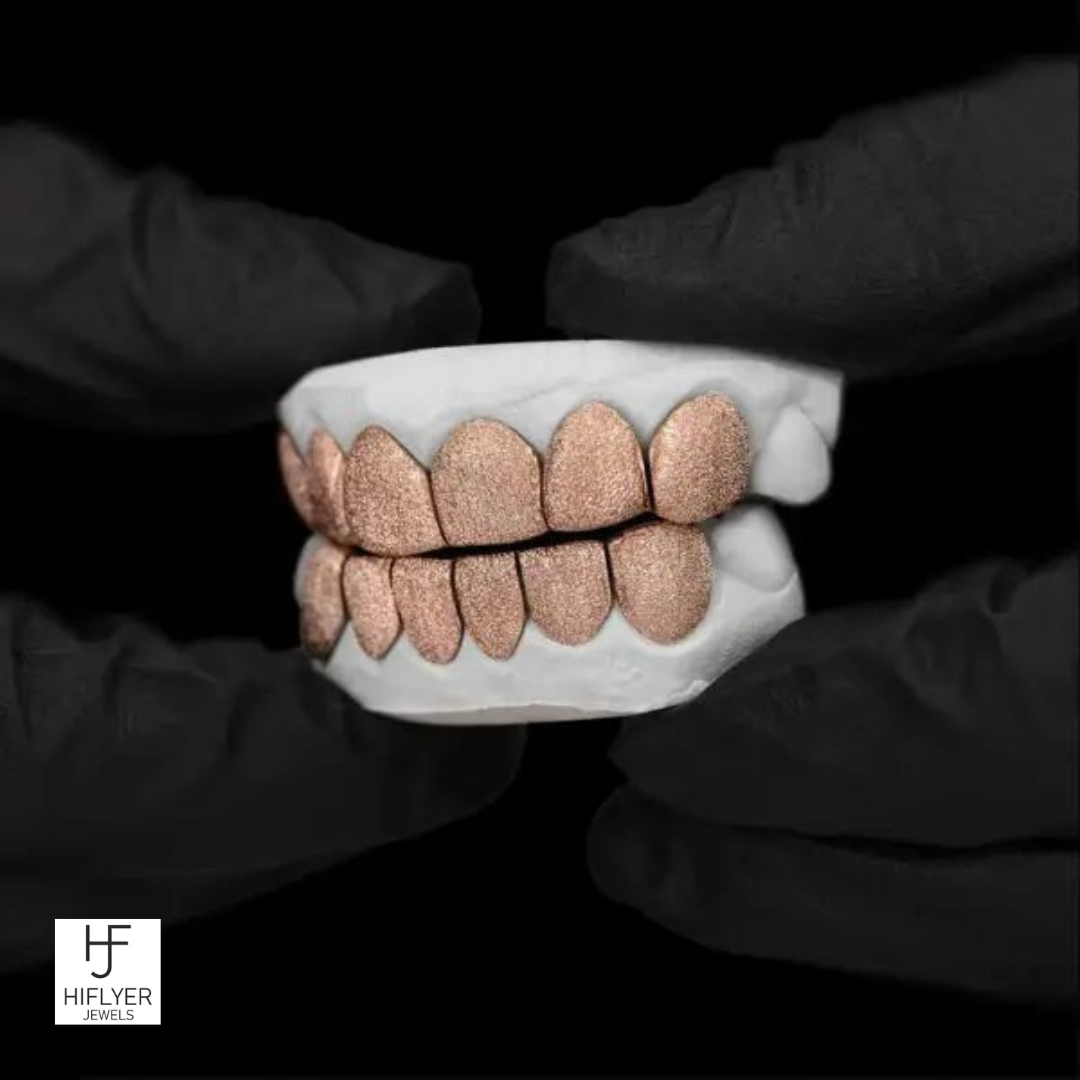 Diamond Dust Grillz- Eversose Gold