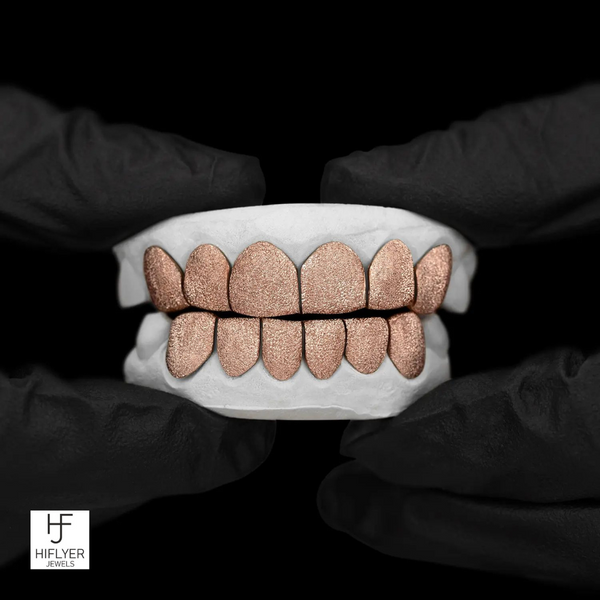 Diamond Dust Grillz- Everose Gold
