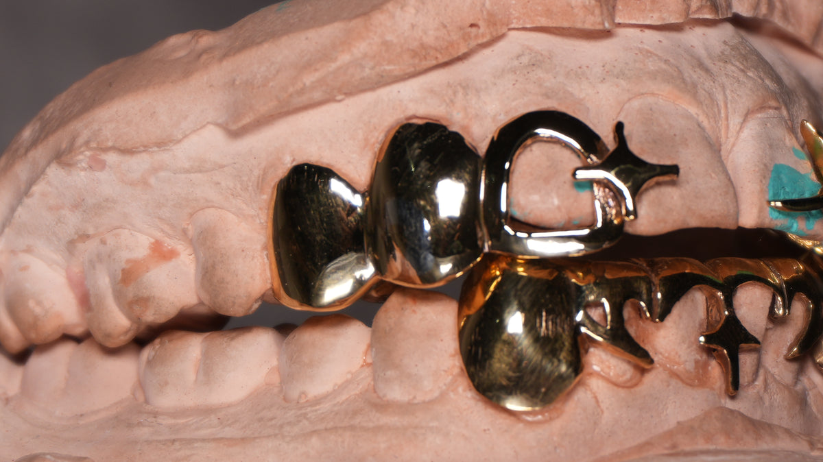牙 Kiba Grillz - Limited to 10 pcs