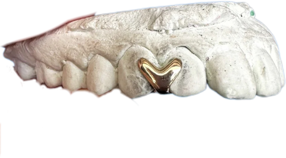 The Love Mold Grillz