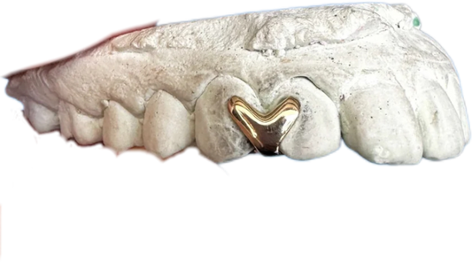 The Love Mold Grillz