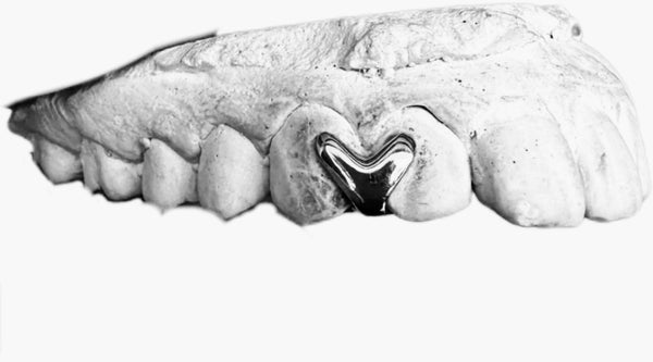 The Love Mold Grillz