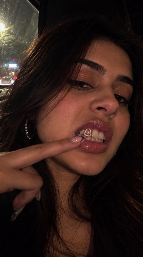 After, wearing HiFlyer grillz