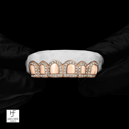 Roman pillar Grillz