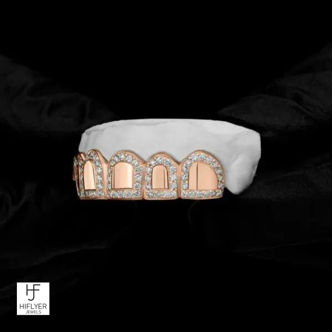Roman pillar Grillz
