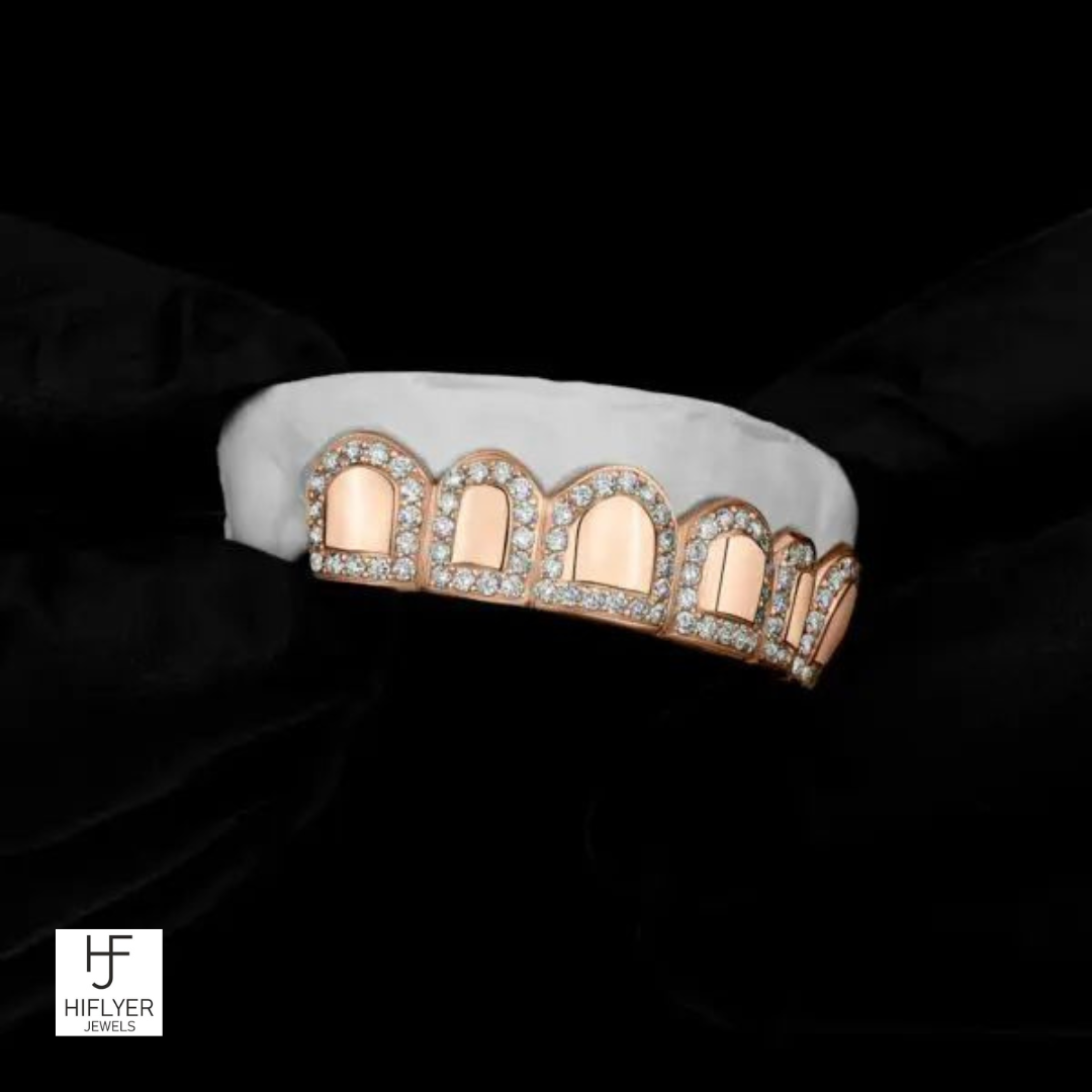Roman pillar Grillz