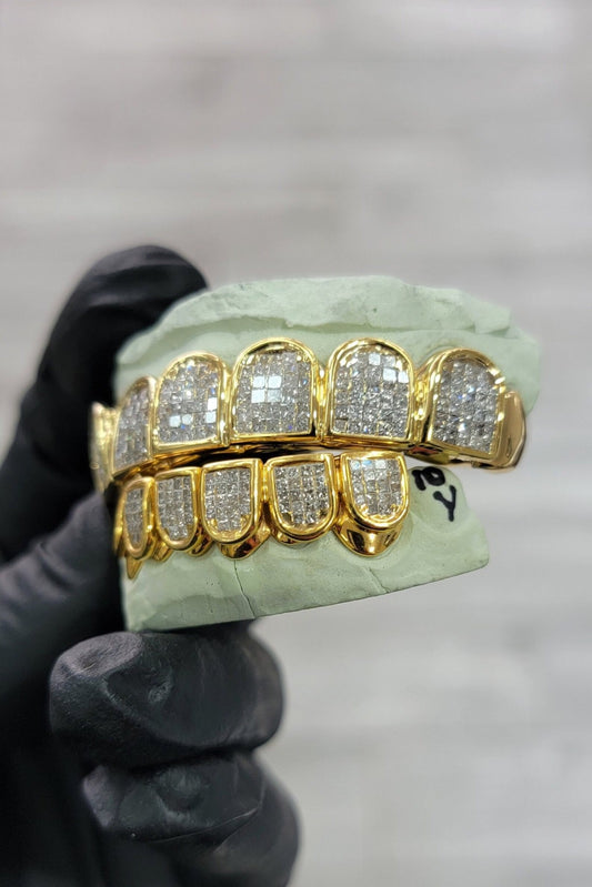 Open Works Invisible Set Emerald Cut Grillz