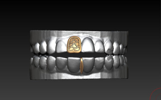Fishscale Grillz