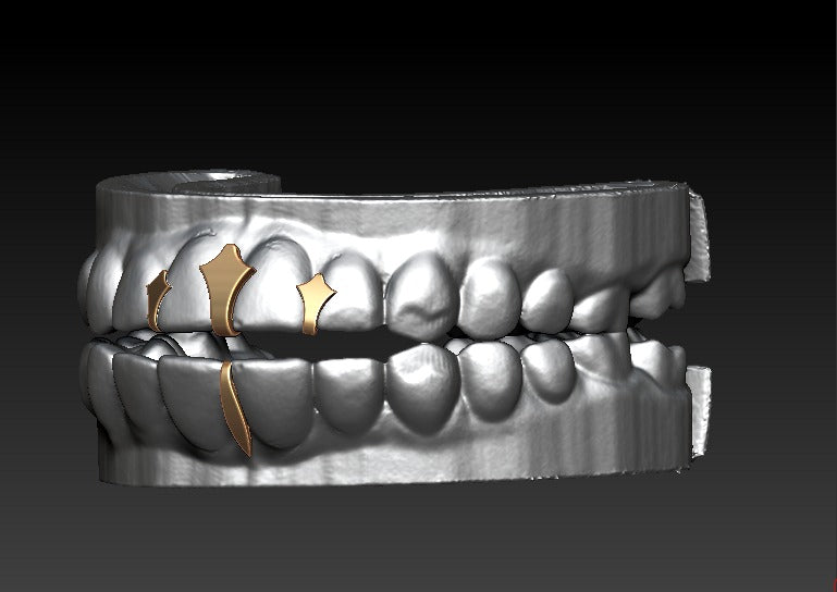 Trident grillz