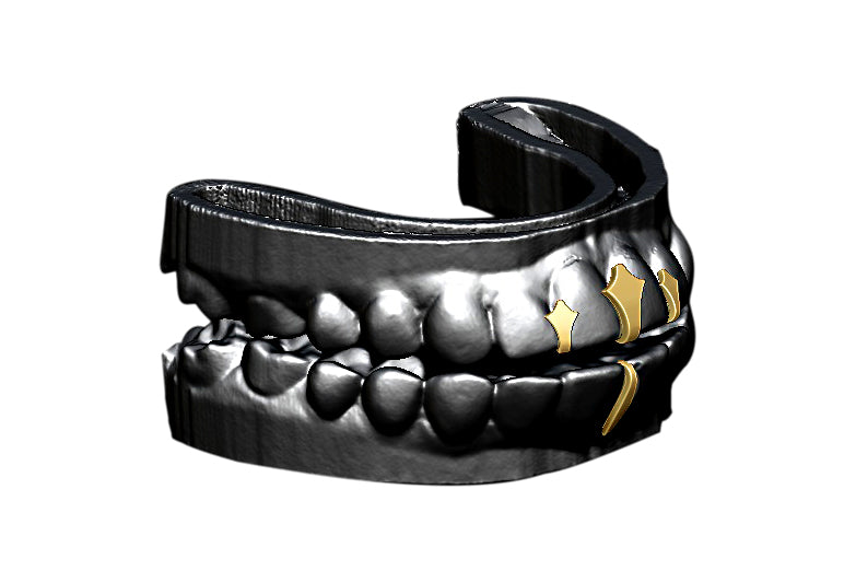 Trident grillz