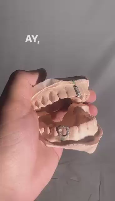 Subtle Ice Grillz- Natural diamonds