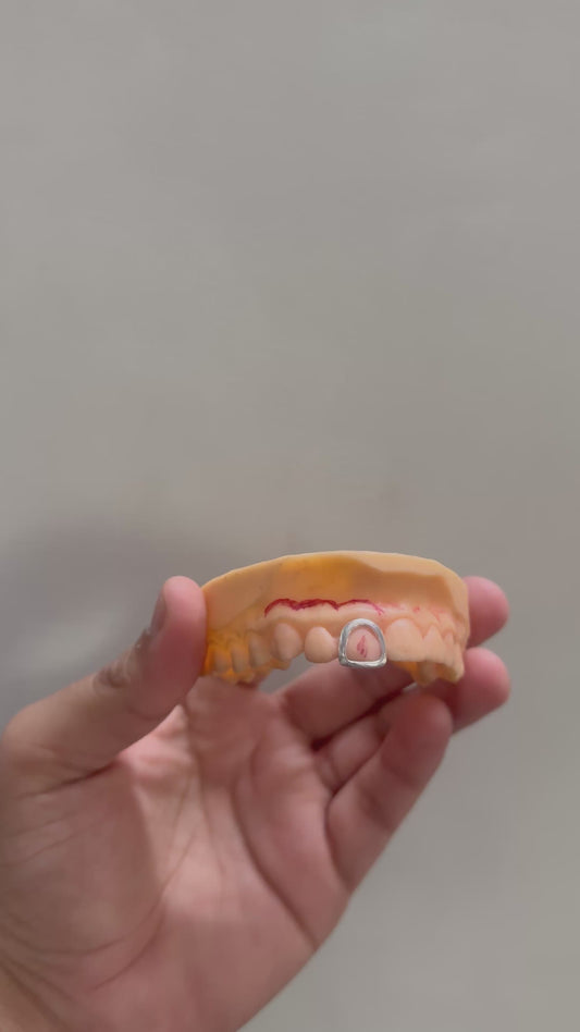 Plain Jane Rim Grillz - Single Cap